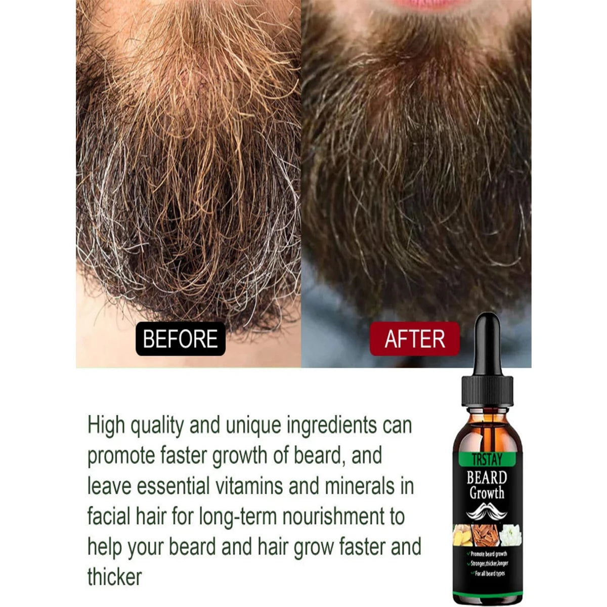 NEW Beard Hair Growth Essential Oil Anti Hair Loss Product Natural Mustache Regrowth Oil for Men Nourishing Beard Care Roller