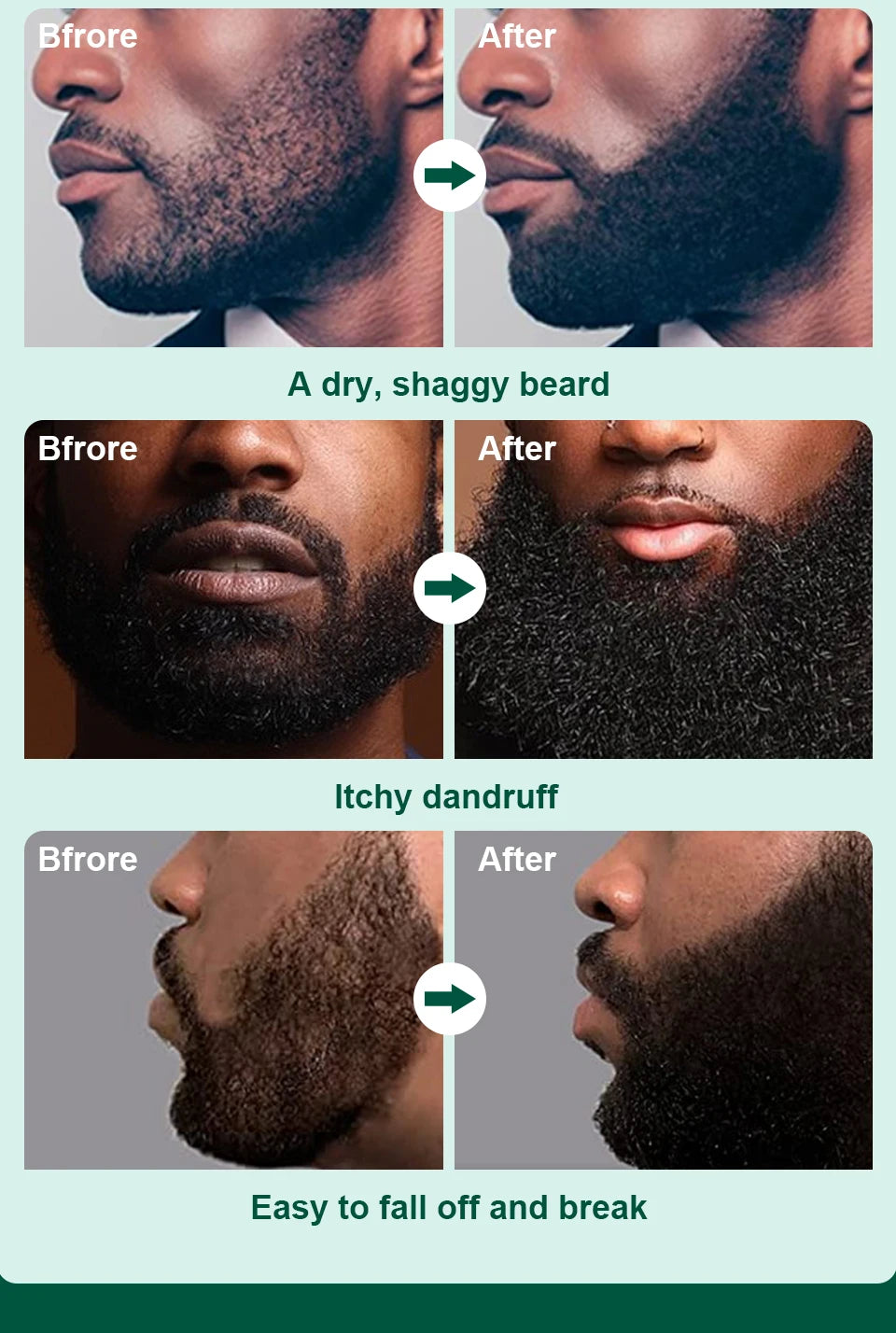 Huile de croissance de barbe pour hommes 100 % naturelle pour la croissance de la barbe Shampooing nourrissant essentiel pour la croissance des cheveux Après-shampoing hydratant et lissant pour la barbe